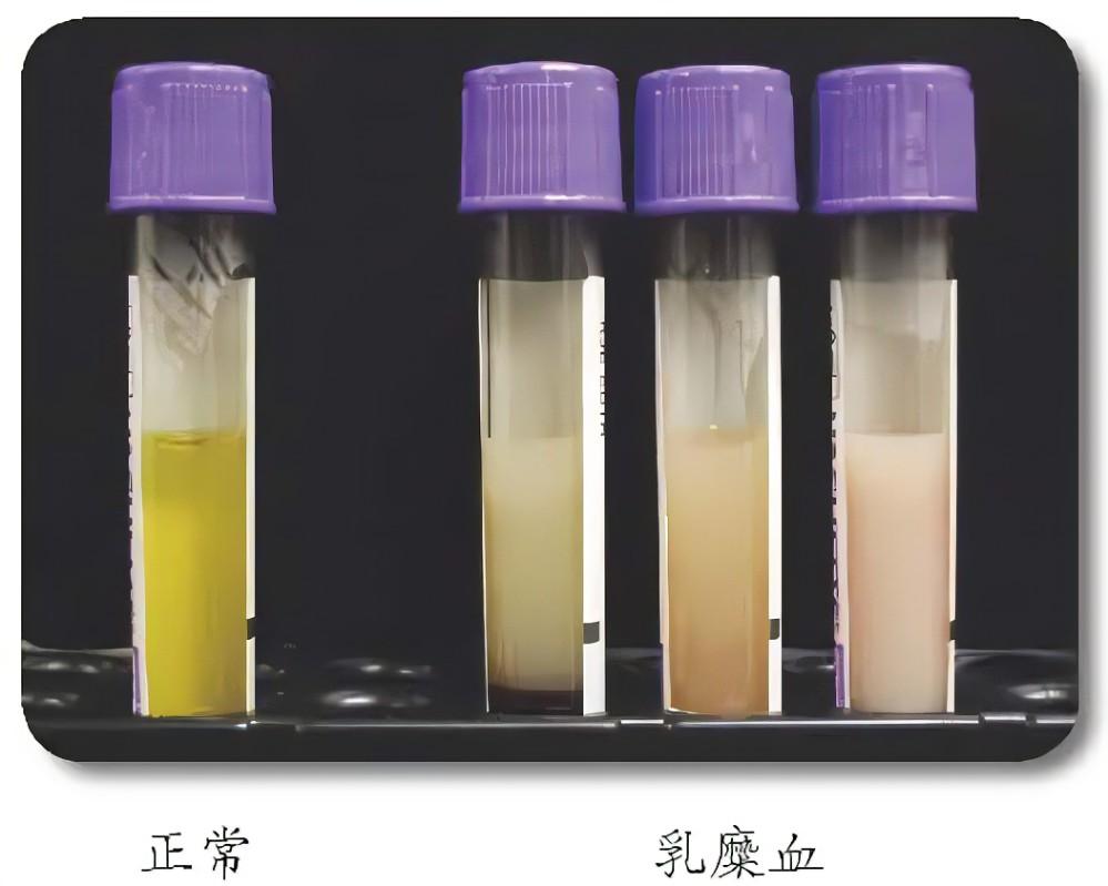 血漿質(zhì)量機(jī)器視覺分級(jí)——從“人眼比色”到“毫秒級(jí)